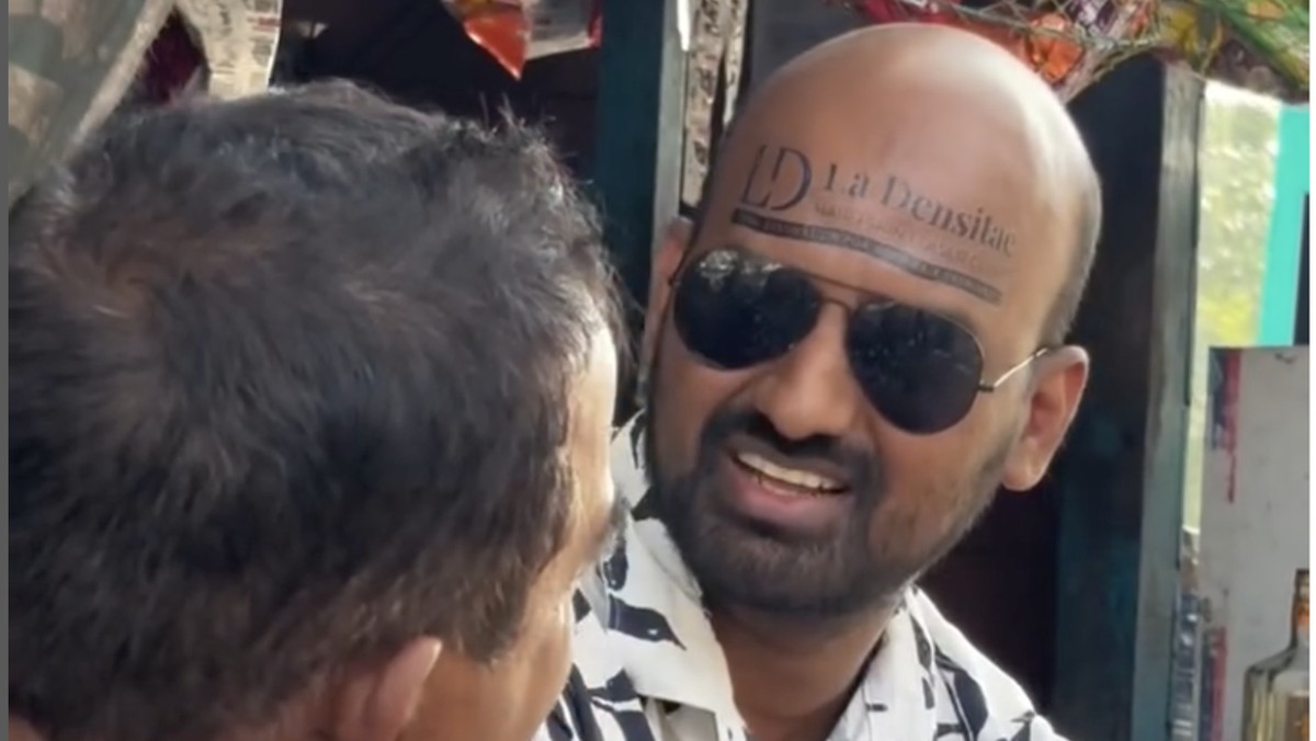 youtuber-india-komersilkan-kepala-botaknya-untuk-pasang-iklan