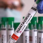 bukan-penyakit-baru,-hantavirus-sudah-ada-di-ri-sejak-1991