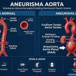 intai-nyawa,-ini-bahaya-gangguan-pada-aorta-jantung
