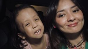 5-potret-terbaru-ziona-anak-joanna-alexandra-yang-idap-penyakit-langka
