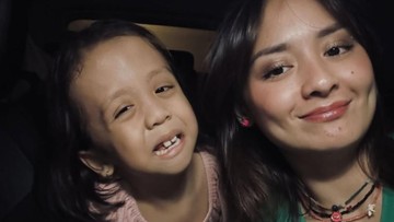 5-potret-terbaru-ziona-anak-joanna-alexandra-yang-idap-penyakit-langka