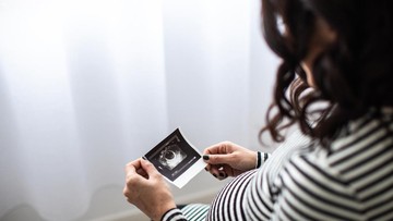 pasangan-ini-putuskan-berpisah-usai-jalani-program-ivf,-bagaimana-hak-asuh-anak?